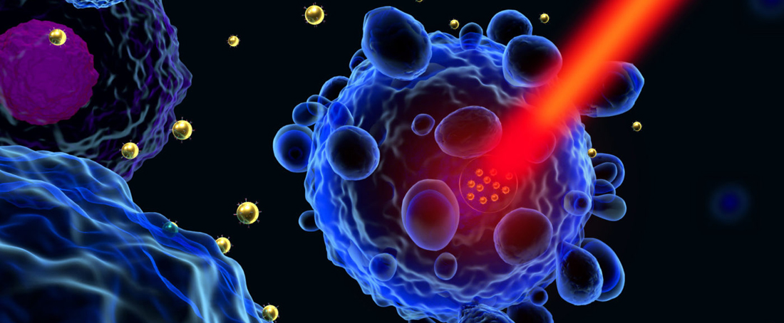 Gold nanoparticles for cancer therapy