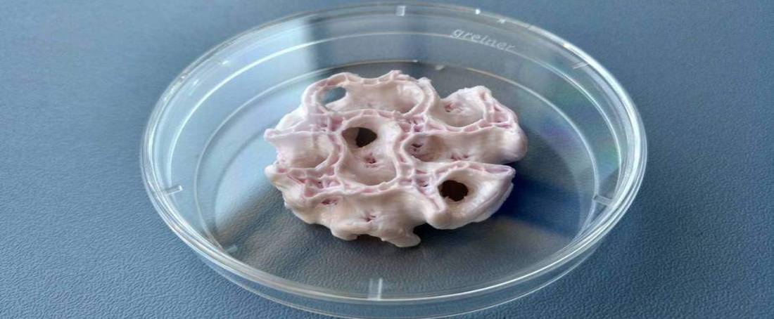 Chitosan-strontium scaffolds for bone tissue engineering