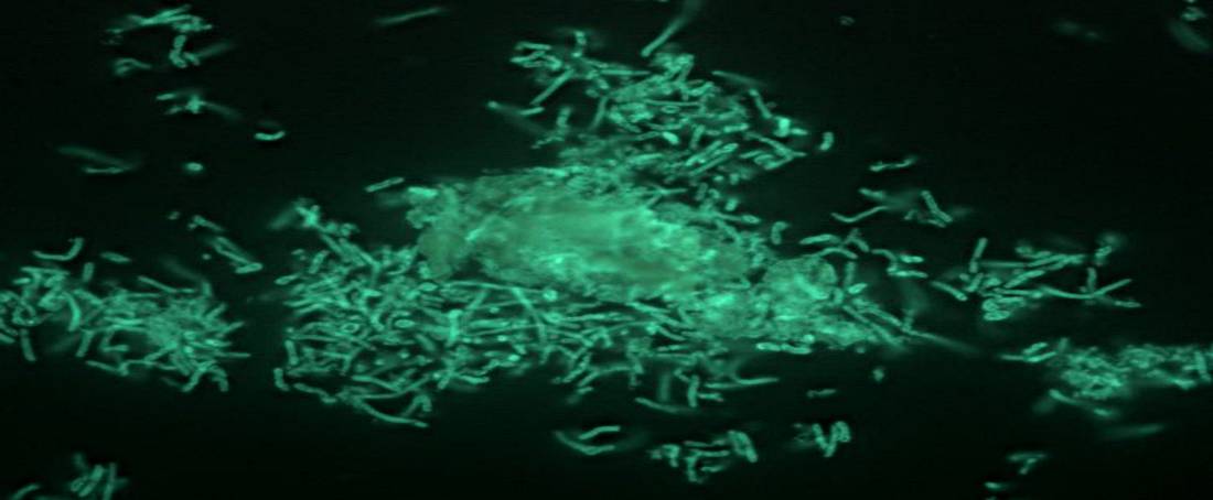 Extremozymes from deep-sea extremophilic microorganisms