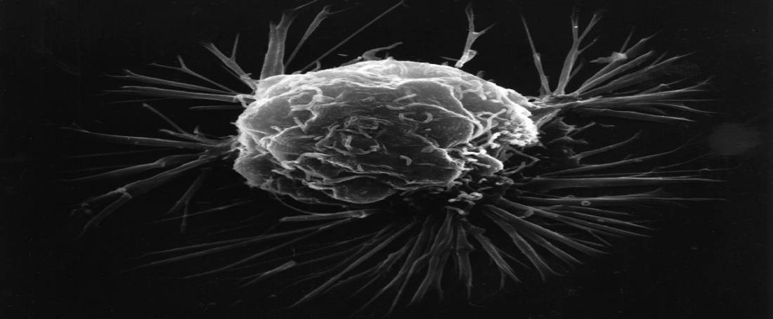 Molecular subtypes of breast cancer