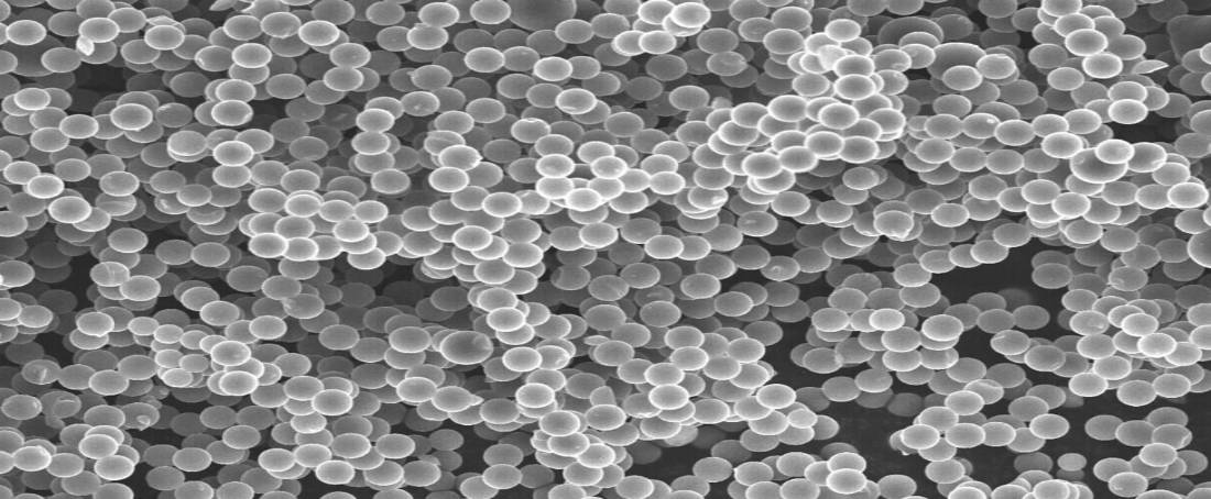 Carbon adsorption using environmentally sustainable carbon spheres