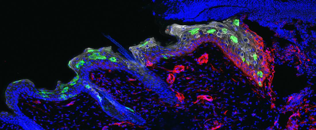 Epidermal stem cells in wound healing 