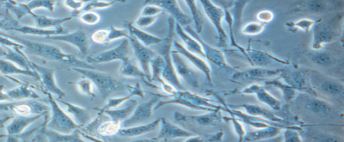 Some insights on CHO-based glycoprotein production