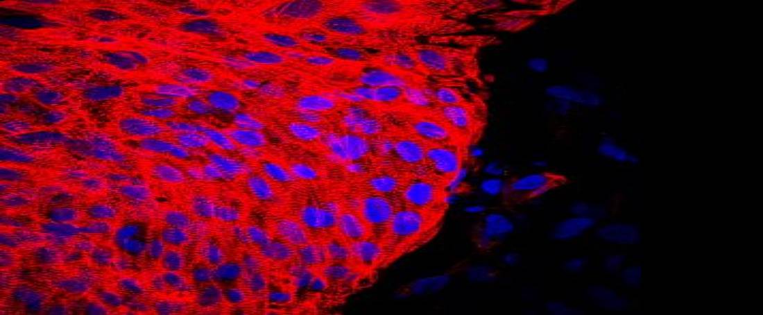 Self morphogenesis of pluripotent stem cells into cardioids