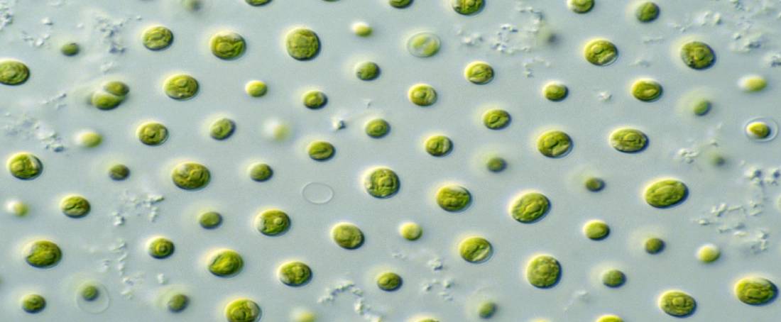 Lipid production by strain development from microalgae