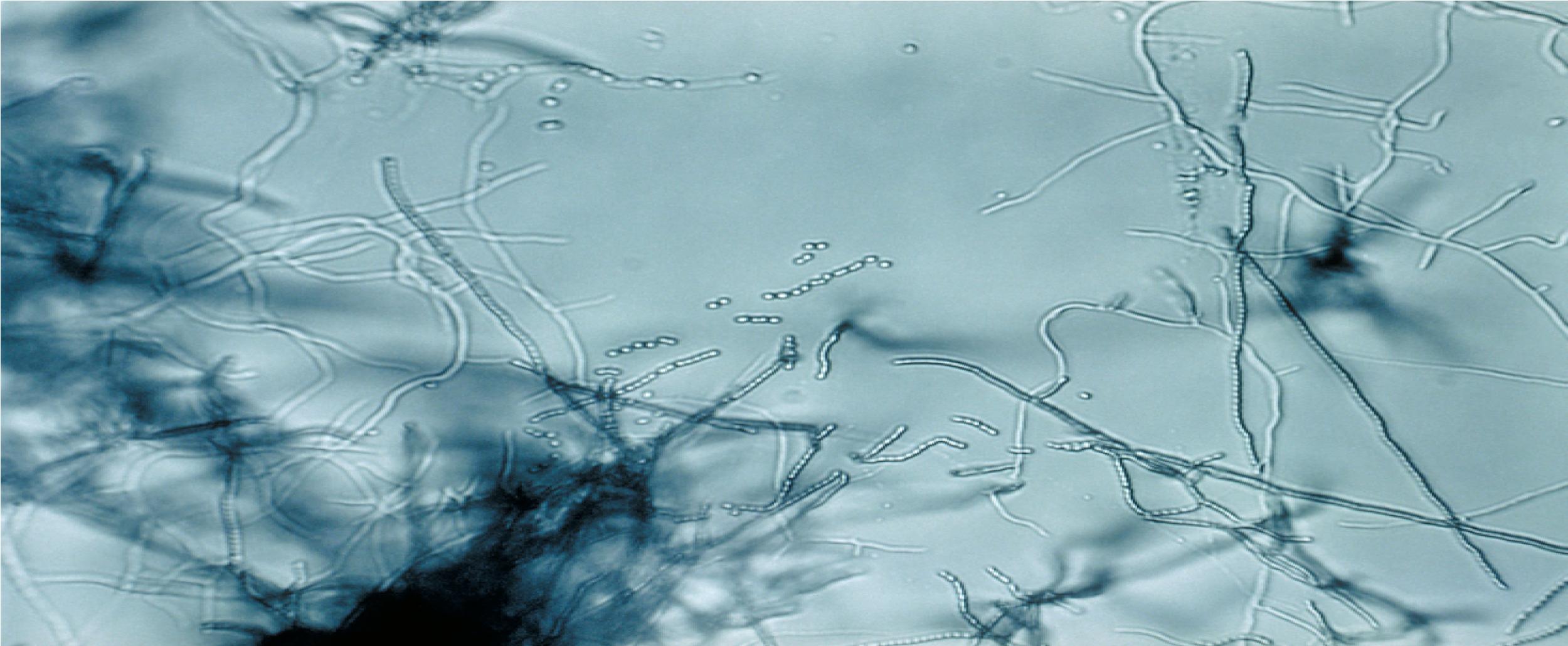 Antibacterial metabolite production using submerged actinomycetes cultivation