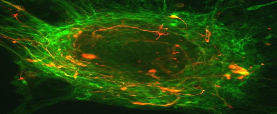 Role of modified stem cells in the treatment of breast cancer