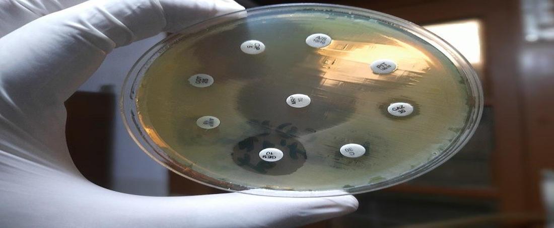 Superbugs: A global threat