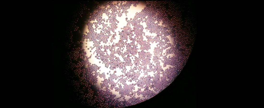 Saccharomyces cerevisiae in cell-free protein synthesis