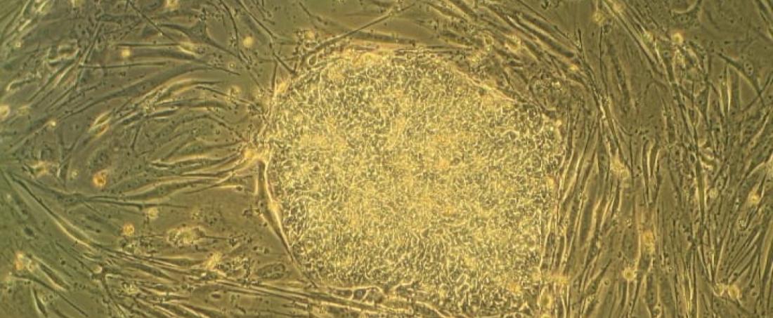 Gene Silencing in mammalian embryonic stem cells using RNA interference technology