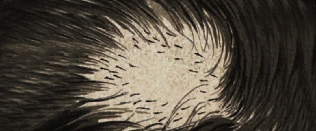 Alopecia areata - a complex autoimmune disease