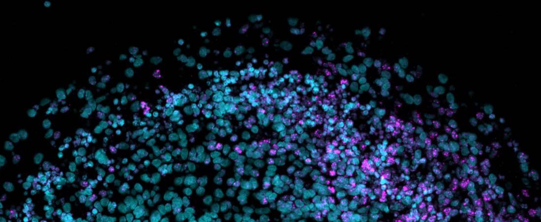 Applications of brain organoids